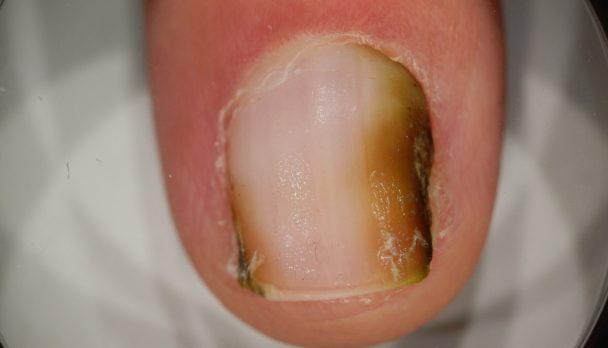 ep 5. green nail_2